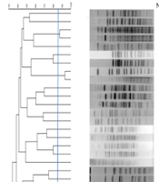 Jundishapur J Microbiol